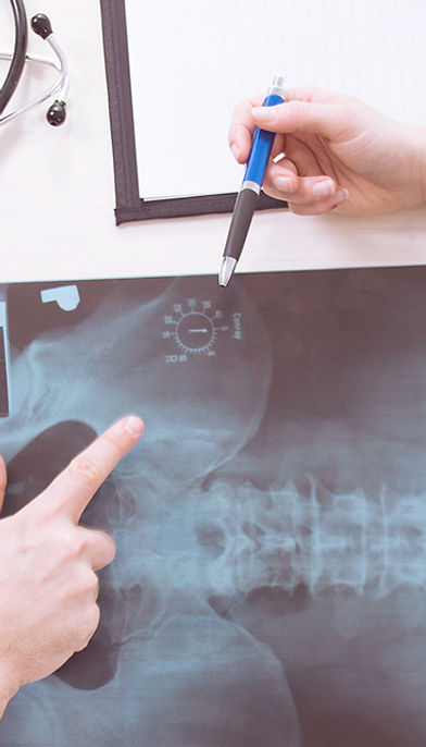 X-Ray Results