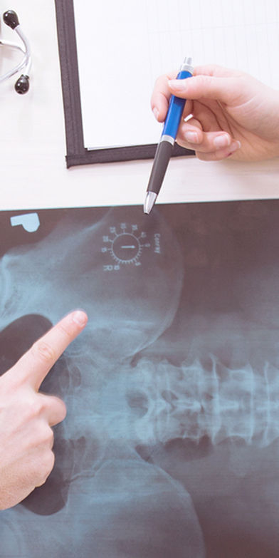 X-Ray Results