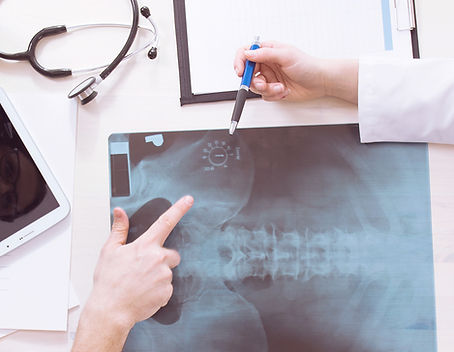 Spinal X-Ray