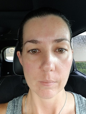woman_facial_AFTER_1.jpeg