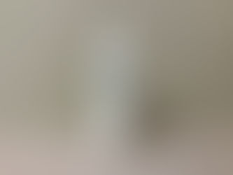 保湿剤はヒュミラックを使っています