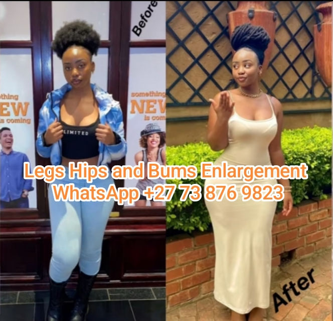 IMG_20250623_legs_hips_and_bums_enlargement.jpg