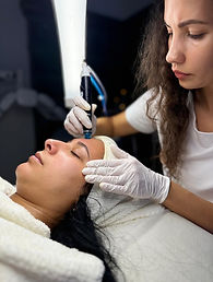 Peeling Vorher Nachher Resultate Rosemi Beauty Studio Luzern kosmetikstudio Hautstraffung