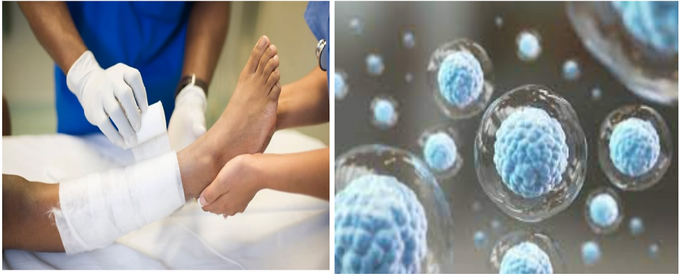 Advanced Wound Care: Revolutionizing Healing for Chronic Wounds in Northern Virginia