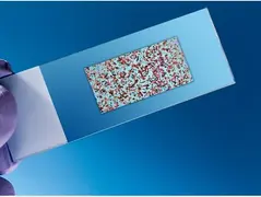 Família mobiliza campanha para custear exame genético de criança em Cachoeira do Sul