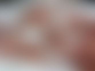 Família de bebê internado com meningite bacteriana pede apoio para custear estadia em Santa Maria