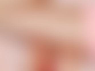 Saúde capacita profissionais para ofertar Implanon na rede pública