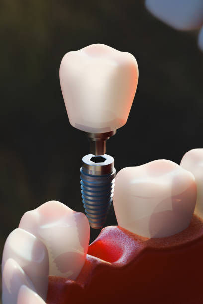 istockphoto-2197893612-612x612.jpg