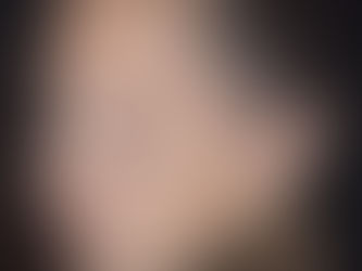 Why Is My Pigmentation Getting Worse?