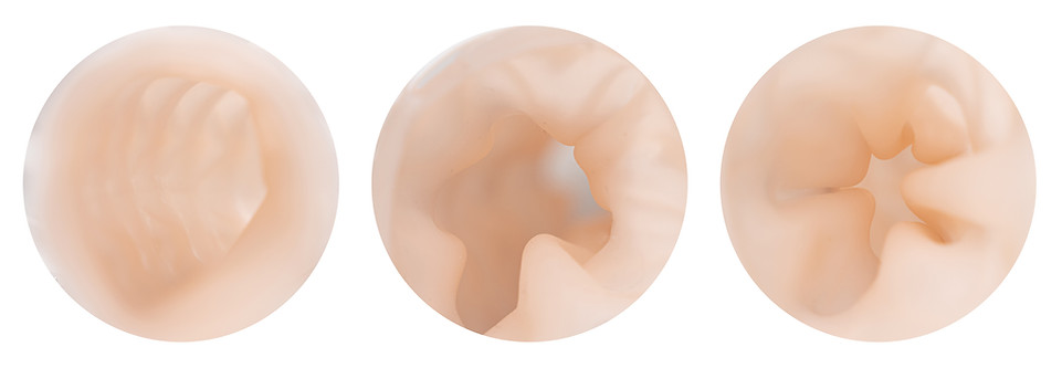 colon_inside-03.jpg