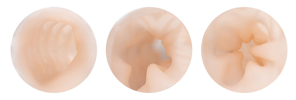 colon_inside-03.jpg