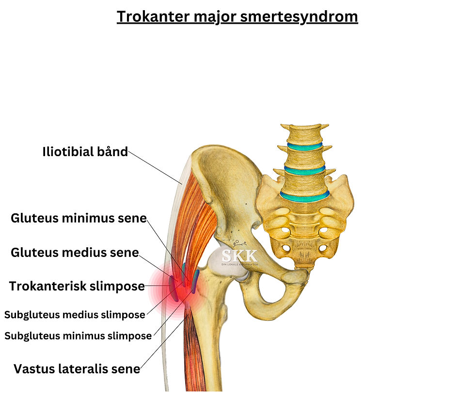 trokanter major smertesyndrom, også kjent som hofte slimposebetennelse. Anatomisk tegning som viser muskler, sener, slimposer i hoften