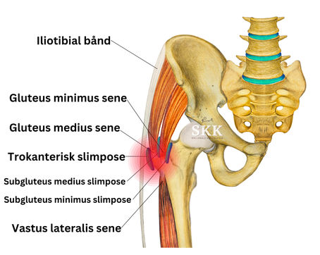 vondt i hoften på utsiden muskler sener slimpost hofte anatomiske bilde