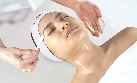 chemical peels.webp