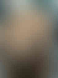 Back of client’s head showing thinning hair and visible scalp before starting CALECIM® hair growth system at L’Elegance Salon