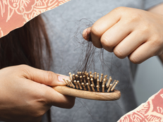 O cabelo que cai volta a nascer?