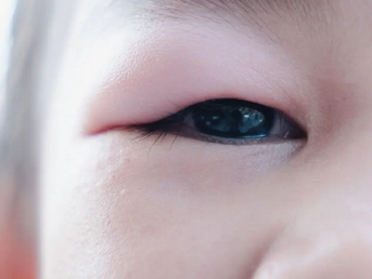 Saiba mais sobre blefarite