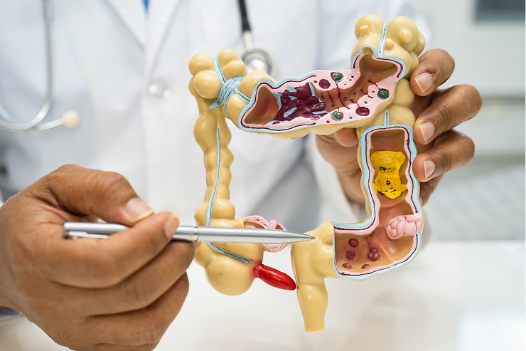 Appendicitis: Understanding the Condition and Treatment Options