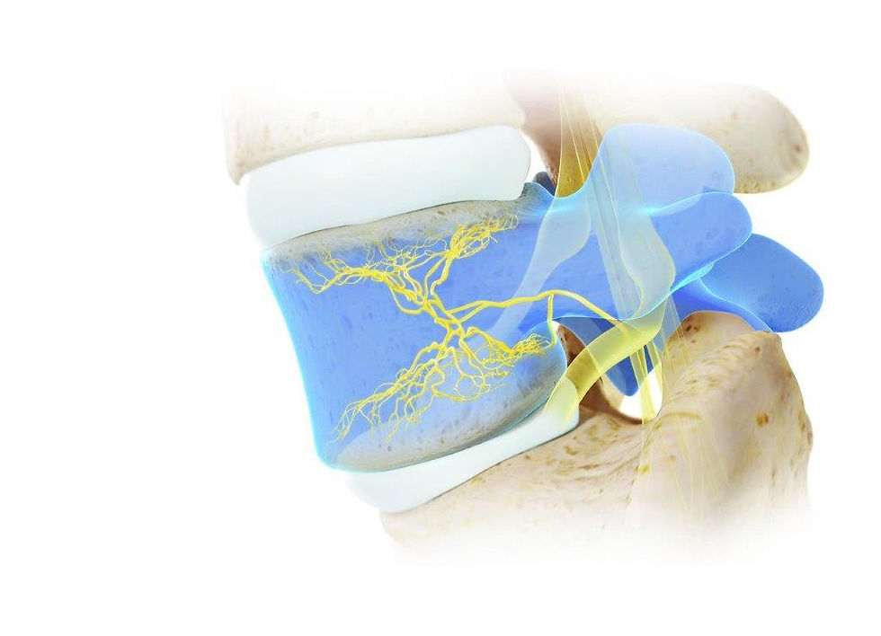 Relievant_Intracept_4K_Still__00935__CMYK_10in.jpg