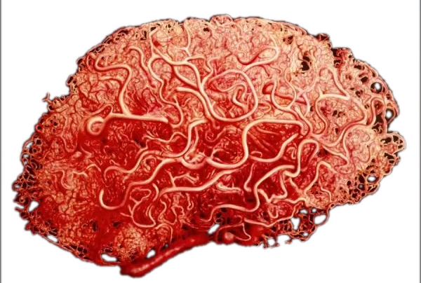 Brain.png