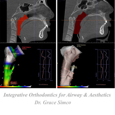 Airway-focused orthodontics