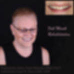 Smile Make Over after Orthodontics