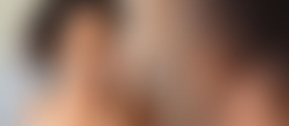 Nose Strips: Your Go-To Option for More Clear Skin