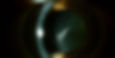 Eye-level view of an ophthalmologist examining a patient's eye