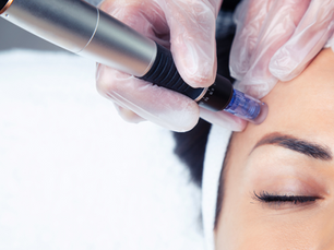 Biohacking in Aesthetics: Luxe Beauty Med Spa in Amarillo, TX A Science-Backed Approach to Radiant Skin