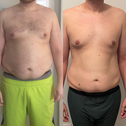 semaglutide patches for weight loss Why GLP-1 Patches Don't Deliver—Yet