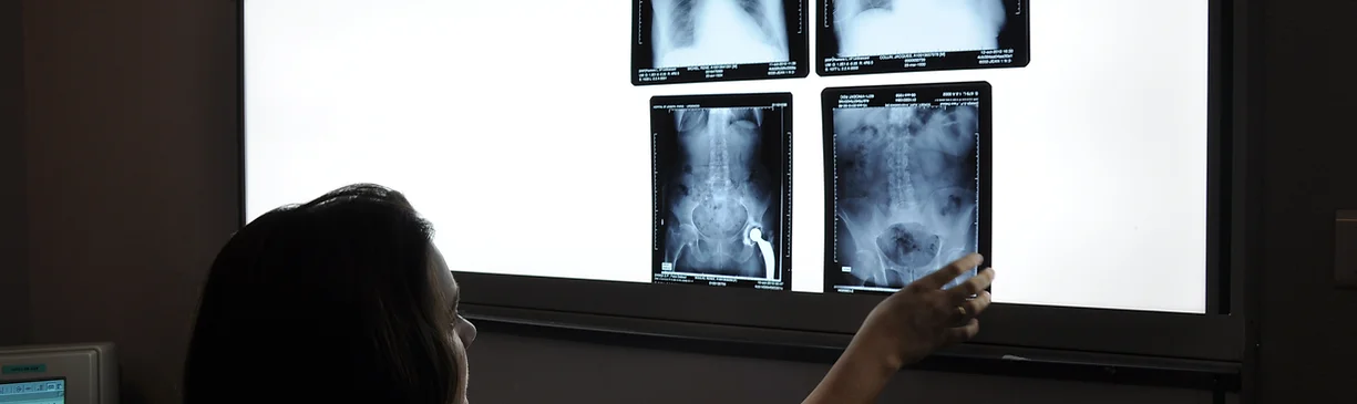 Camelback Imaging | Radiology Reads, Teleradiology, Second Opinion Services | Neuroradiological, Acute Trauma, Musculoskeletal, Body & Personal Injury