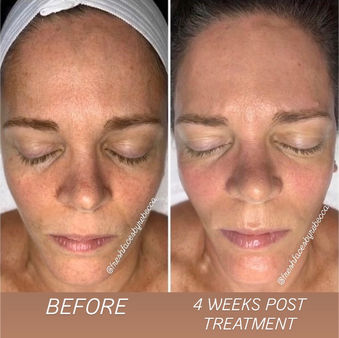 Before and After photo