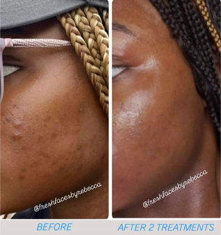 Before and After photo