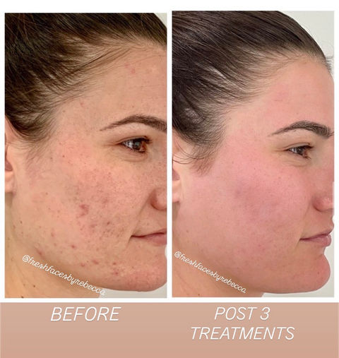 Before and After photo