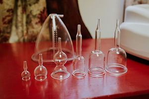 LivingMassageandWellness Cupping.jpg