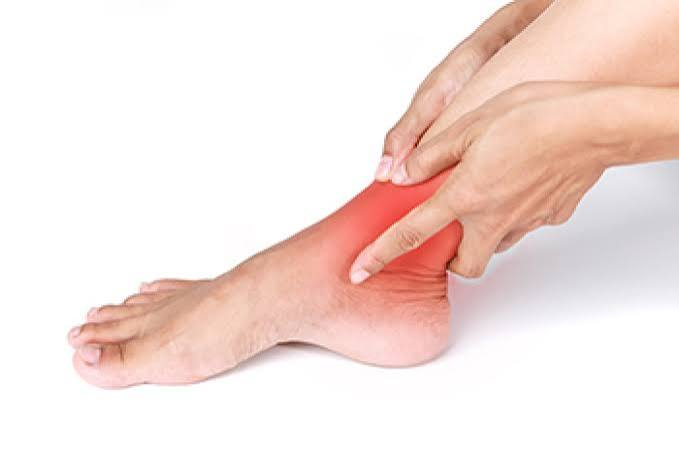 Posterior Tibial Tendon Dysfunction (PTTD)