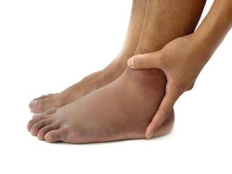 Peroneal Tendonitis vs. Peroneal Tendon Tear: How to Tell the Difference
