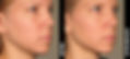 Face_10_1x