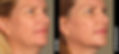 Face_08_1x