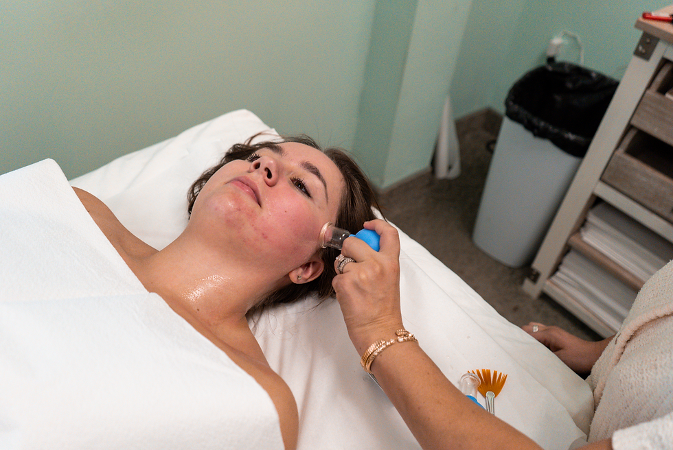 Facial Cupping