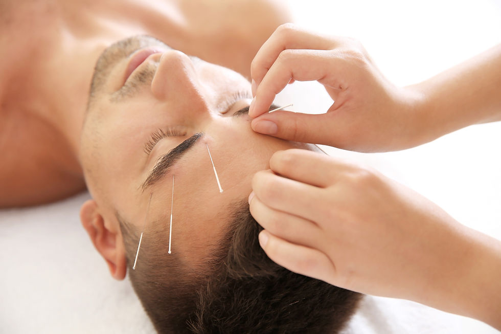 Why Choose Facial Acupuncture Over Botox: A Natural, Whole-Body Approach