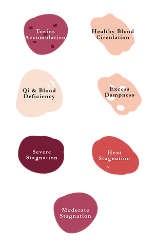 Cupping Colors | Cupping | Michigan Acupuncture Studio