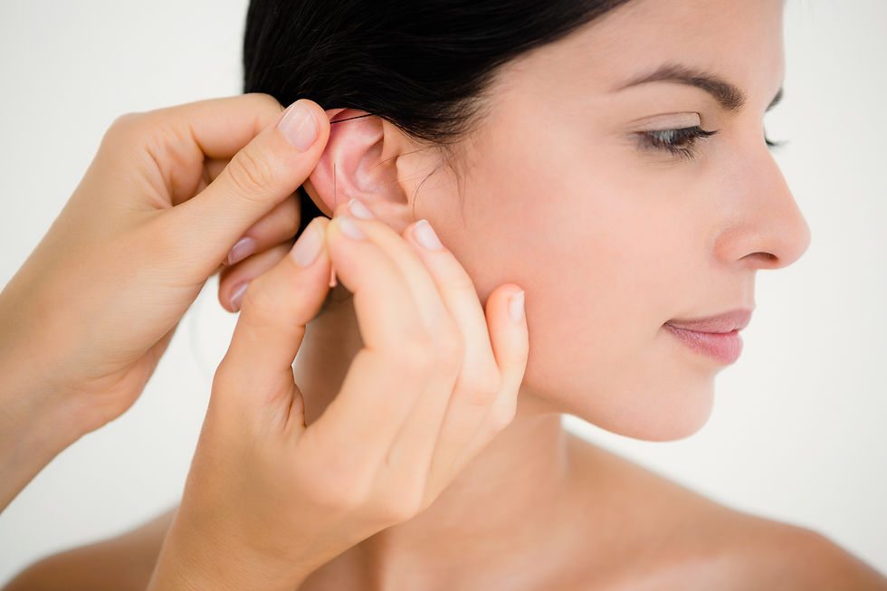 Acupuncture Ears