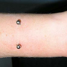 Left Wrist Surface Piercing by Carla.jpg