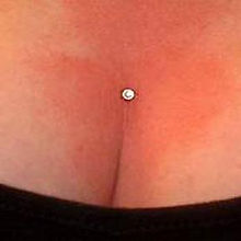 Dermal between the Breast by Carla Hubbard.jpg