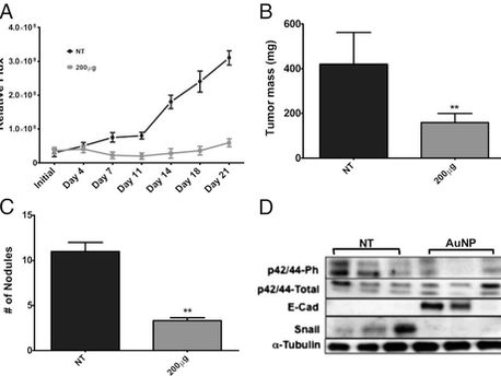 Inhibición del crecimiento tumoral y metástasis con Nanopartículas auto-terapéuticas de Oro