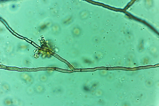 Highly beneficial fungi structure