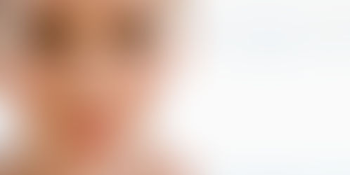 自閉スペクトラム症の女性