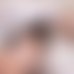 Pourquoi perd-on ses cheveux ?