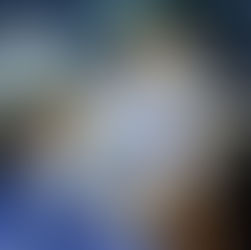 Comment se préparer à une greffe de cheveux à Istanbul ?